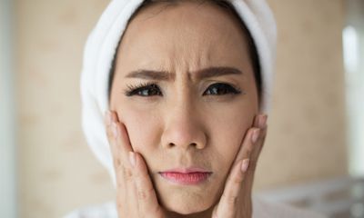 Untuk Menutupi Jerawat dan Bekas Jerawat Pilih Concealer Berwarna Kehijauan dan Bertekstur Padat Untuk Menutupi Jerawat dan Bekas Jerawat Pilih Concealer Berwarna Kehijauan dan Bertekstur Padat