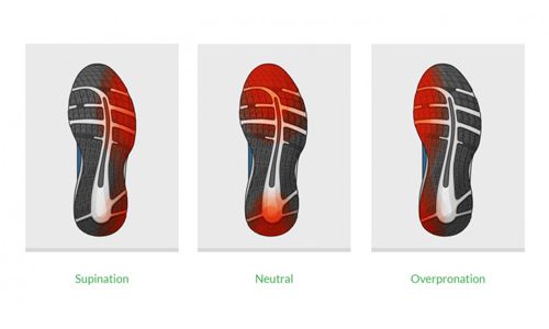 Perhatikan Bentuk Kaki yang Mempengaruhi Cara Berlari Anda Perhatikan Bentuk Kaki yang Mempengaruhi Cara Berlari Anda
