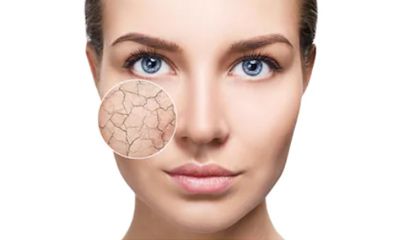 Untuk Kulit Kering Carilah Suplemen dengan Kandungan Beberapa Jenis Vitamin B C dan E Untuk Kulit Kering Carilah Suplemen dengan Kandungan Beberapa Jenis Vitamin B C dan E